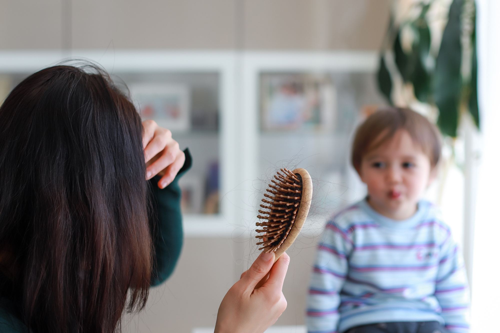 Postpartum Hair Loss - Causes, Prevention and Treatment Options